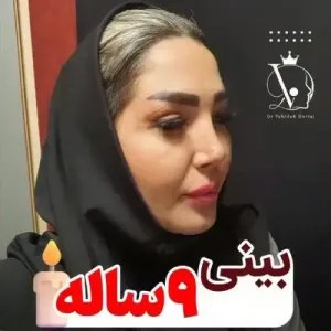 جراحی-بینی-130