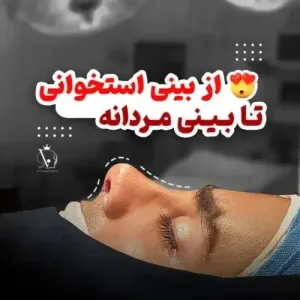 جراحی-بینی-131