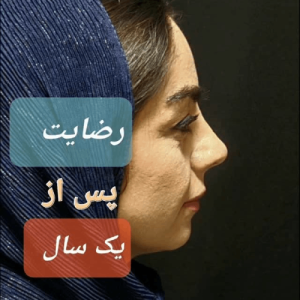 جراحی-بینی-139