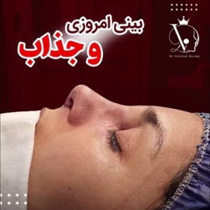 جراحی-بینی-147