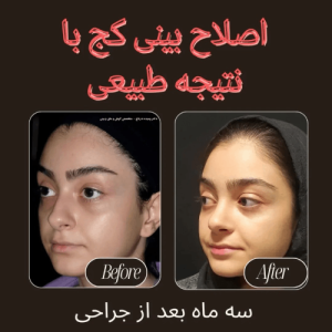 جراحی-یبنی-142