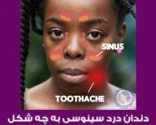 تفاوت دندان درد و دندان درد ناشی از عفونت سینوس