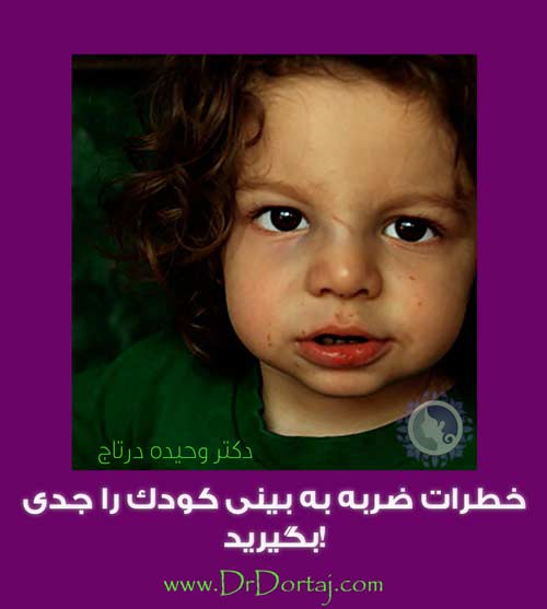 خطرات ضربه به بینی کودک