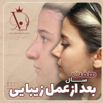 جراحی بینی - دکتر وحیده درتاج