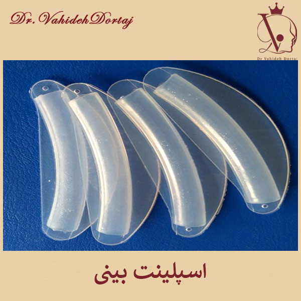 انواع اسپلینت بینی _ دکتر وحیده درتاج