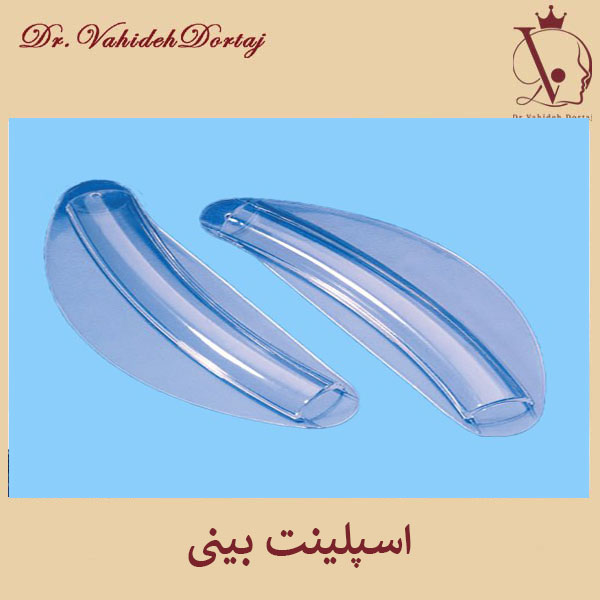 اسپلینت بینی _ دکتر وحیده درتاج