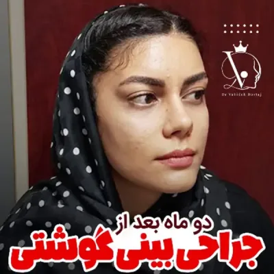 بهترین جراح بینی تهران _ دکتر وحیده درتاج