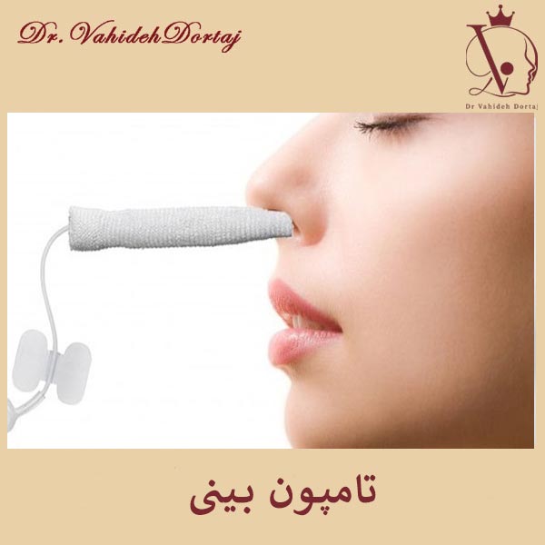 تامپون در جراحی بینی _ دکتر وحیده درتاج