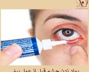 پماد زدن چشم قبل از عمل بینی _ دکتر وحیده درتاج