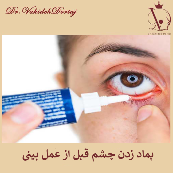 پماد زدن چشم قبل از عمل بینی _ دکتر وحیده درتاج